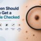 when to get mole checked in australia 85x85